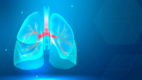 akciğer hacim azaltıcı