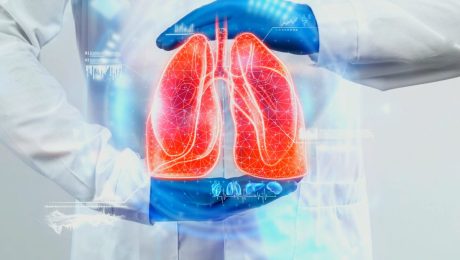 akciğer zarı kanseri