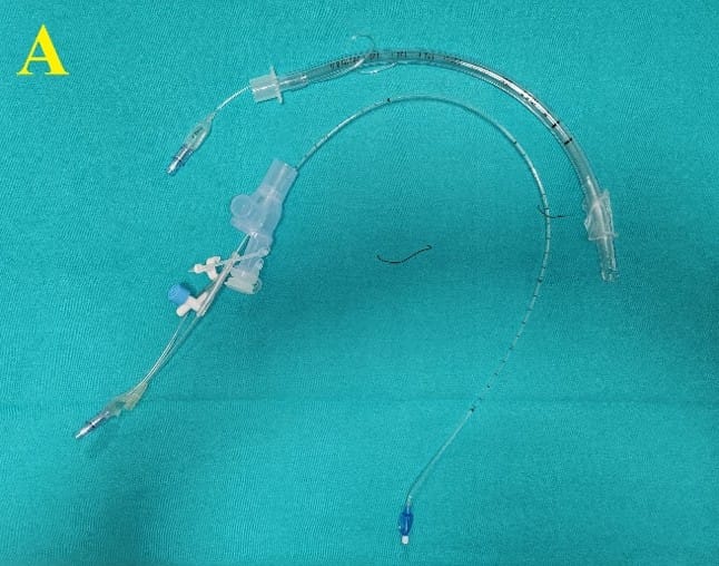Pediatrik Gögüs Cerrahisi Pediatrik Gögüs Cerrahisi