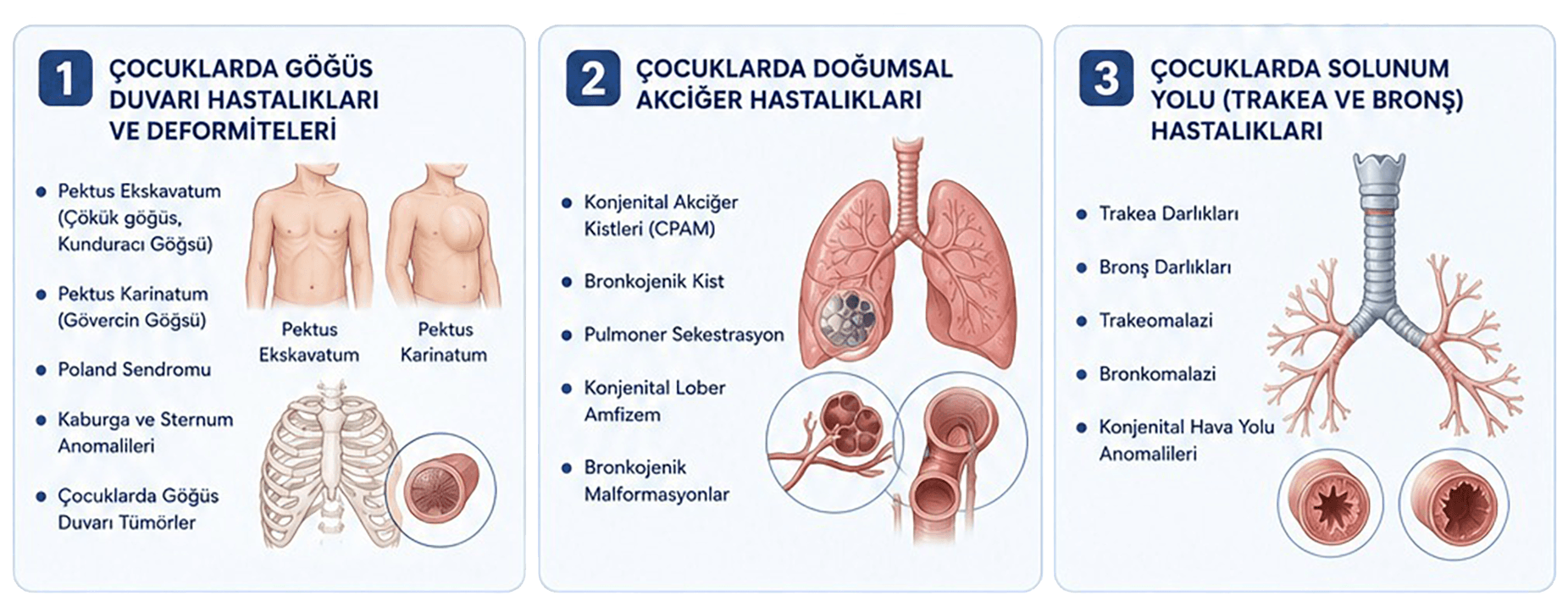 Pediatrik göğüs cerrahisinde hastalık grupları ve tedavi alanları 1 2 3
