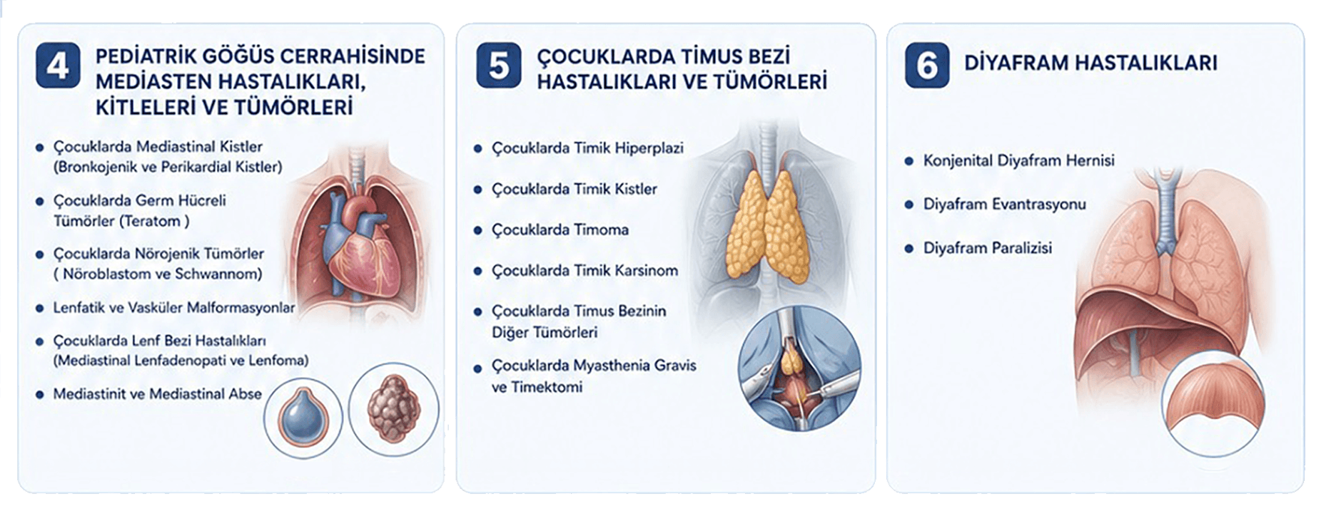 Pediatrik göğüs cerrahisinde hastalık grupları ve tedavi alanları 4 5 6